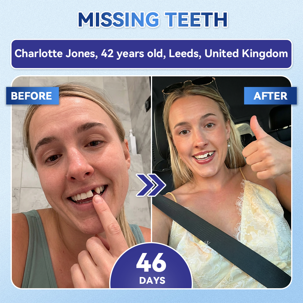 🦷𝐆𝐥𝐢𝐦𝐦𝐞𝐫𝐥𝐲® 𝐓𝐢𝐝𝐞𝐠𝐥𝐮𝐬𝐢𝐛 𝐓𝐨𝐨𝐭𝐡 & 𝐆𝐮𝐦 𝐑𝐞𝐩𝐚𝐢𝐫 𝐌𝐢𝐜𝐫𝐨𝐧𝐞𝐞𝐝𝐥𝐞 𝐏𝐚𝐭𝐜𝐡  | 𝐀𝐝𝐯𝐚𝐧𝐜𝐞𝐝 𝐒𝐭𝐞𝐦-𝐂𝐞𝐥𝐥 𝐀𝐜𝐭𝐢𝐯𝐚𝐭𝐢𝐨𝐧 𝐓𝐞𝐞𝐭𝐡 𝐒𝐭𝐫𝐢𝐩𝐬(🦷𝐑𝐞𝐛𝐮𝐢𝐥𝐝 𝐄𝐧𝐚𝐦𝐞𝐥 & 𝐃𝐞𝐧𝐭𝐢𝐧 • 𝐒𝐭𝐫𝐞𝐧𝐠𝐭𝐡𝐞𝐧 𝐆𝐮𝐦𝐬 • 𝐄𝐫𝐚𝐝𝐢𝐜𝐚𝐭𝐞 𝐓𝐚𝐫𝐭𝐚𝐫 & 𝐎𝐝𝐨𝐫 • 𝐒𝐭𝐨𝐩 𝐓𝐨𝐨𝐭𝐡 𝐒𝐞𝐧𝐬𝐢𝐭𝐢𝐯𝐢𝐭𝐲) 3.0（英国）