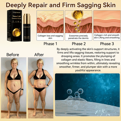 🌿𝐸𝐷𝐼𝐽𝑂𝑁𝐴𝐻® 𝑆𝑡𝑒𝑚 𝐶𝑒𝑙𝑙 𝐸𝑥𝑜𝑠𝑜𝑚𝑒 𝑆𝑒𝑟𝑢𝑚 -（ Anti-aging, reduces wrinkles, improves firmness, enhances radiance, provides deep hydration）英国  外泌体抗皱 定稿（副本）