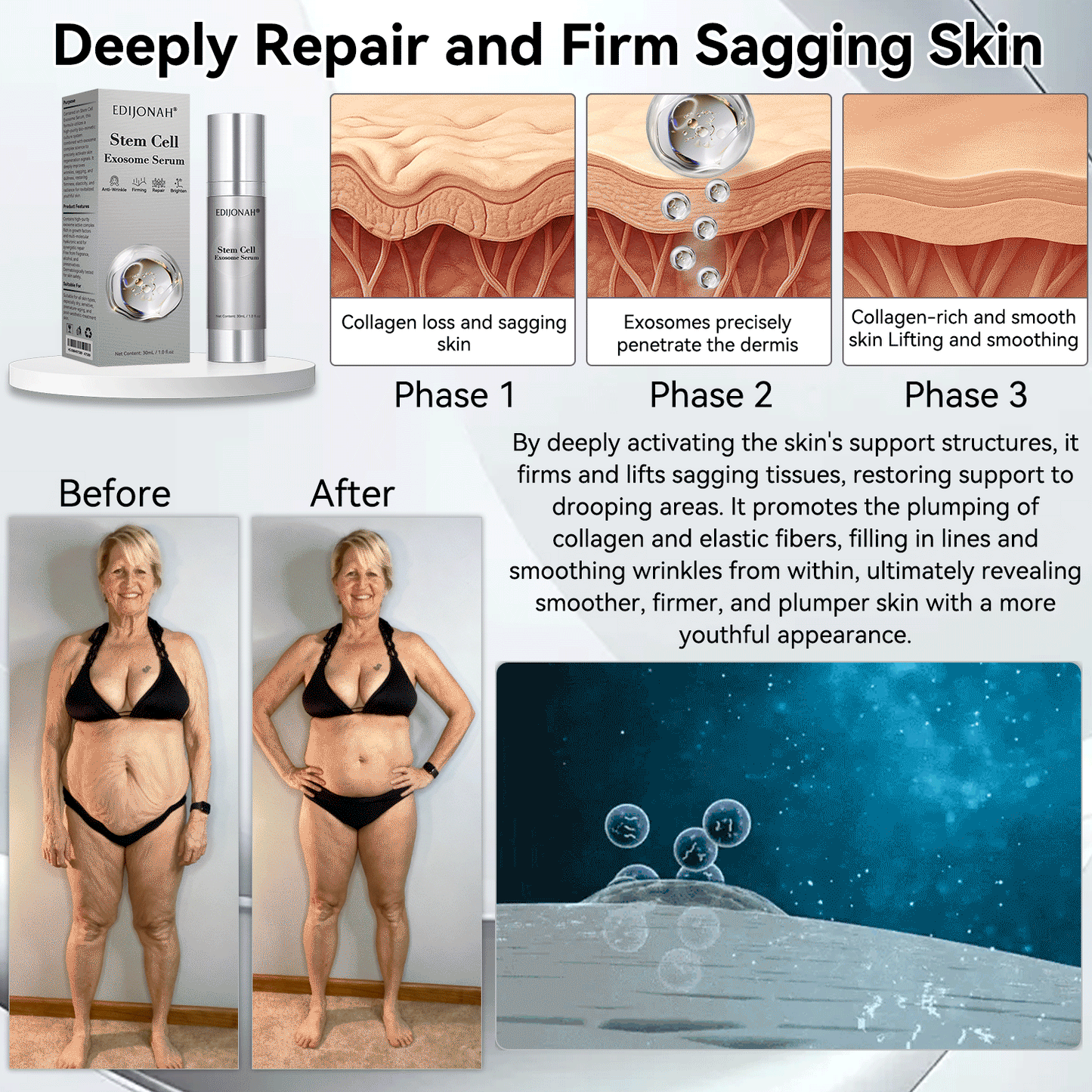 🎯🎯𝐸𝐷𝐼𝐽𝑂𝑁𝐴𝐻® 𝑆𝑡𝑒𝑚 𝐶𝑒𝑙𝑙 𝐸𝑥𝑜𝑠𝑜𝑚𝑒 𝑆𝑒𝑟𝑢𝑚  🐬🐬（ Anti-aging, reduces wrinkles, improves firmness, enhances radiance, provides deep hydration）