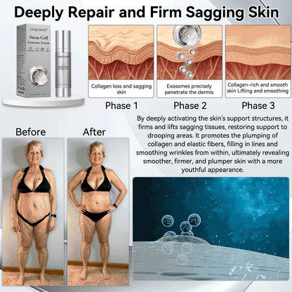 🎯🎯𝐸𝐷𝐼𝐽𝑂𝑁𝐴𝐻® 𝑆𝑡𝑒𝑚 𝐶𝑒𝑙𝑙 𝐸𝑥𝑜𝑠𝑜𝑚𝑒 𝑆𝑒𝑟𝑢𝑚  🐬🐬（ Anti-aging, reduces wrinkles, improves firmness, enhances radiance, provides deep hydration）