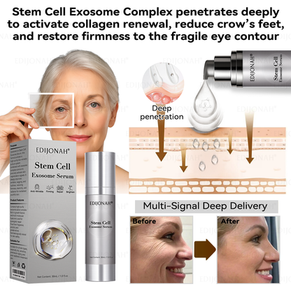🎯🎯𝐸𝐷𝐼𝐽𝑂𝑁𝐴𝐻® 𝑆𝑡𝑒𝑚 𝐶𝑒𝑙𝑙 𝐸𝑥𝑜𝑠𝑜𝑚𝑒 𝑆𝑒𝑟𝑢𝑚  🐬🐬（ Anti-aging, reduces wrinkles, improves firmness, enhances radiance, provides deep hydration）