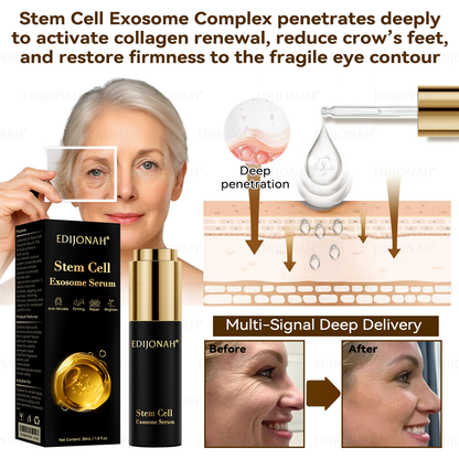 🌿𝐸𝐷𝐼𝐽𝑂𝑁𝐴𝐻® 𝑆𝑡𝑒𝑚 𝐶𝑒𝑙𝑙 𝐸𝑥𝑜𝑠𝑜𝑚𝑒 𝑆𝑒𝑟𝑢𝑚 -（ Anti-aging, reduces wrinkles, improves firmness, enhances radiance, provides deep hydration）英国  外泌体抗皱 定稿（副本）