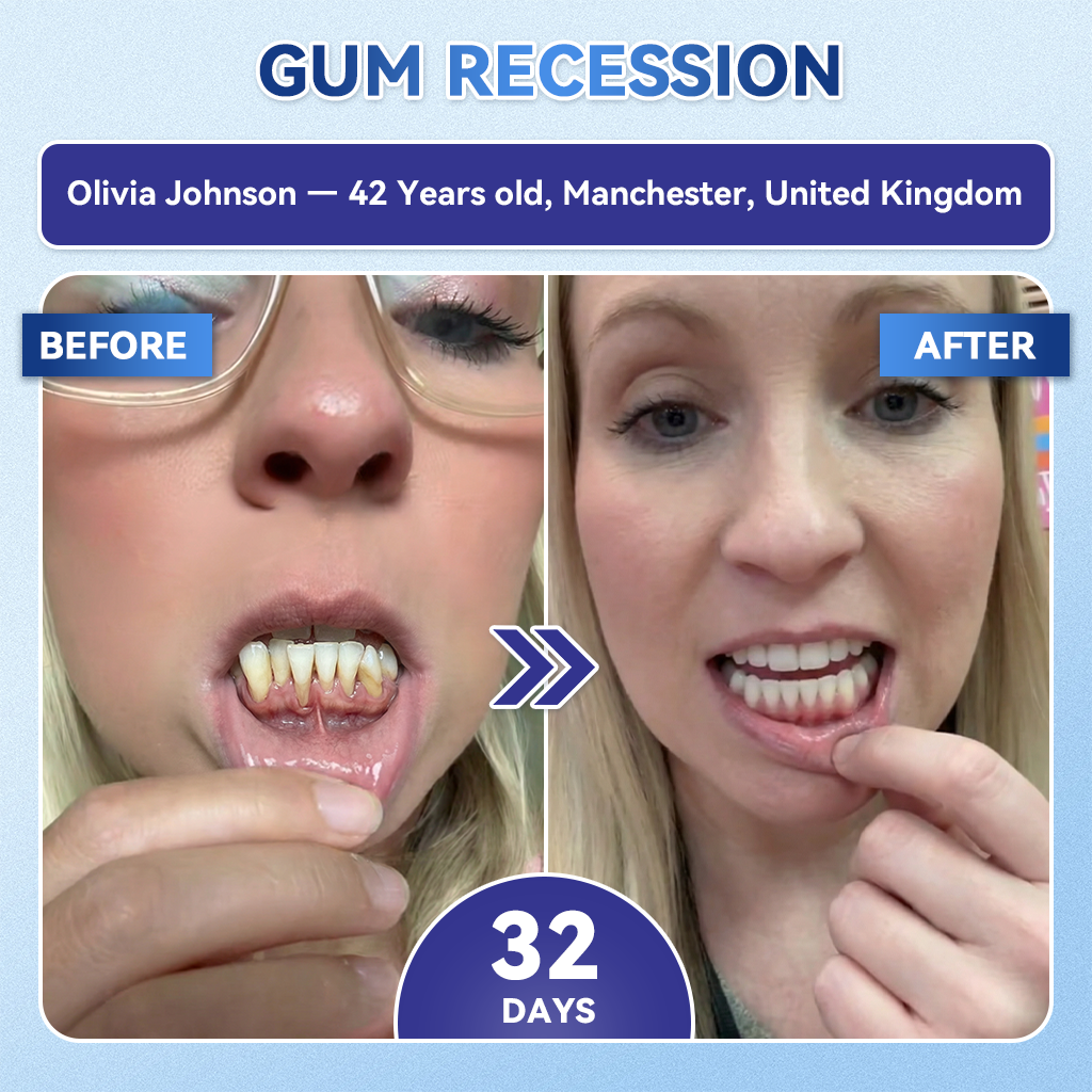 🦷𝐆𝐥𝐢𝐦𝐦𝐞𝐫𝐥𝐲® 𝐓𝐢𝐝𝐞𝐠𝐥𝐮𝐬𝐢𝐛 𝐓𝐨𝐨𝐭𝐡 & 𝐆𝐮𝐦 𝐑𝐞𝐩𝐚𝐢𝐫 𝐌𝐢𝐜𝐫𝐨𝐧𝐞𝐞𝐝𝐥𝐞 𝐏𝐚𝐭𝐜𝐡  | 𝐀𝐝𝐯𝐚𝐧𝐜𝐞𝐝 𝐒𝐭𝐞𝐦-𝐂𝐞𝐥𝐥 𝐀𝐜𝐭𝐢𝐯𝐚𝐭𝐢𝐨𝐧 𝐓𝐞𝐞𝐭𝐡 𝐒𝐭𝐫𝐢𝐩𝐬(🦷𝐑𝐞𝐛𝐮𝐢𝐥𝐝 𝐄𝐧𝐚𝐦𝐞𝐥 & 𝐃𝐞𝐧𝐭𝐢𝐧 • 𝐒𝐭𝐫𝐞𝐧𝐠𝐭𝐡𝐞𝐧 𝐆𝐮𝐦𝐬 • 𝐄𝐫𝐚𝐝𝐢𝐜𝐚𝐭𝐞 𝐓𝐚𝐫𝐭𝐚𝐫 & 𝐎𝐝𝐨𝐫 • 𝐒𝐭𝐨𝐩 𝐓𝐨𝐨𝐭𝐡 𝐒𝐞𝐧𝐬𝐢𝐭𝐢𝐯𝐢𝐭𝐲) 3.0（英国）