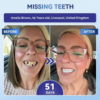 🦷𝐆𝐥𝐢𝐦𝐦𝐞𝐫𝐥𝐲® 𝐓𝐢𝐝𝐞𝐠𝐥𝐮𝐬𝐢𝐛 𝐓𝐨𝐨𝐭𝐡 & 𝐆𝐮𝐦 𝐑𝐞𝐩𝐚𝐢𝐫 𝐌𝐢𝐜𝐫𝐨𝐧𝐞𝐞𝐝𝐥𝐞 𝐏𝐚𝐭𝐜𝐡  | 𝐀𝐝𝐯𝐚𝐧𝐜𝐞𝐝 𝐒𝐭𝐞𝐦-𝐂𝐞𝐥𝐥 𝐀𝐜𝐭𝐢𝐯𝐚𝐭𝐢𝐨𝐧 𝐓𝐞𝐞𝐭𝐡 𝐒𝐭𝐫𝐢𝐩𝐬(🦷𝐑𝐞𝐛𝐮𝐢𝐥𝐝 𝐄𝐧𝐚𝐦𝐞𝐥 & 𝐃𝐞𝐧𝐭𝐢𝐧 • 𝐒𝐭𝐫𝐞𝐧𝐠𝐭𝐡𝐞𝐧 𝐆𝐮𝐦𝐬 • 𝐄𝐫𝐚𝐝𝐢𝐜𝐚𝐭𝐞 𝐓𝐚𝐫𝐭𝐚𝐫 & 𝐎𝐝𝐨𝐫 • 𝐒𝐭𝐨𝐩 𝐓𝐨𝐨𝐭𝐡 𝐒𝐞𝐧𝐬𝐢𝐭𝐢𝐯𝐢𝐭𝐲) 3.0（英国）
