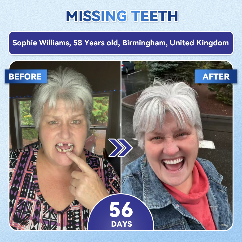 🦷𝐆𝐥𝐢𝐦𝐦𝐞𝐫𝐥𝐲® 𝐓𝐢𝐝𝐞𝐠𝐥𝐮𝐬𝐢𝐛 𝐓𝐨𝐨𝐭𝐡 & 𝐆𝐮𝐦 𝐑𝐞𝐩𝐚𝐢𝐫 𝐌𝐢𝐜𝐫𝐨𝐧𝐞𝐞𝐝𝐥𝐞 𝐏𝐚𝐭𝐜𝐡  | 𝐀𝐝𝐯𝐚𝐧𝐜𝐞𝐝 𝐒𝐭𝐞𝐦-𝐂𝐞𝐥𝐥 𝐀𝐜𝐭𝐢𝐯𝐚𝐭𝐢𝐨𝐧 𝐓𝐞𝐞𝐭𝐡 𝐒𝐭𝐫𝐢𝐩𝐬(🦷𝐑𝐞𝐛𝐮𝐢𝐥𝐝 𝐄𝐧𝐚𝐦𝐞𝐥 & 𝐃𝐞𝐧𝐭𝐢𝐧 • 𝐒𝐭𝐫𝐞𝐧𝐠𝐭𝐡𝐞𝐧 𝐆𝐮𝐦𝐬 • 𝐄𝐫𝐚𝐝𝐢𝐜𝐚𝐭𝐞 𝐓𝐚𝐫𝐭𝐚𝐫 & 𝐎𝐝𝐨𝐫 • 𝐒𝐭𝐨𝐩 𝐓𝐨𝐨𝐭𝐡 𝐒𝐞𝐧𝐬𝐢𝐭𝐢𝐯𝐢𝐭𝐲) 3.0（英国）