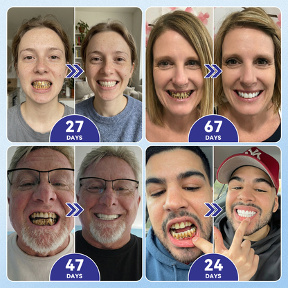 🦷𝐆𝐥𝐢𝐦𝐦𝐞𝐫𝐥𝐲® 𝐓𝐢𝐝𝐞𝐠𝐥𝐮𝐬𝐢𝐛 𝐓𝐨𝐨𝐭𝐡 & 𝐆𝐮𝐦 𝐑𝐞𝐩𝐚𝐢𝐫 𝐌𝐢𝐜𝐫𝐨𝐧𝐞𝐞𝐝𝐥𝐞 𝐏𝐚𝐭𝐜𝐡  | 𝐀𝐝𝐯𝐚𝐧𝐜𝐞𝐝 𝐒𝐭𝐞𝐦-𝐂𝐞𝐥𝐥 𝐀𝐜𝐭𝐢𝐯𝐚𝐭𝐢𝐨𝐧 𝐓𝐞𝐞𝐭𝐡 𝐒𝐭𝐫𝐢𝐩𝐬(🦷𝐑𝐞𝐛𝐮𝐢𝐥𝐝 𝐄𝐧𝐚𝐦𝐞𝐥 & 𝐃𝐞𝐧𝐭𝐢𝐧 • 𝐒𝐭𝐫𝐞𝐧𝐠𝐭𝐡𝐞𝐧 𝐆𝐮𝐦𝐬 • 𝐄𝐫𝐚𝐝𝐢𝐜𝐚𝐭𝐞 𝐓𝐚𝐫𝐭𝐚𝐫 & 𝐎𝐝𝐨𝐫 • 𝐒𝐭𝐨𝐩 𝐓𝐨𝐨𝐭𝐡 𝐒𝐞𝐧𝐬𝐢𝐭𝐢𝐯𝐢𝐭𝐲) 3.0（英国）