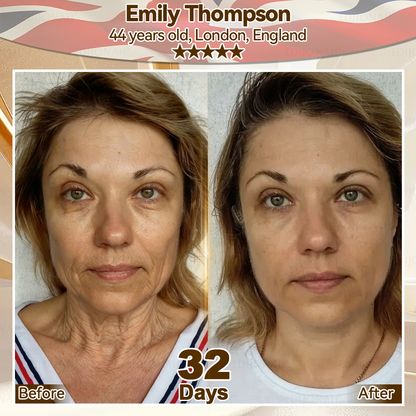 🌿𝐸𝐷𝐼𝐽𝑂𝑁𝐴𝐻® 𝑆𝑡𝑒𝑚 𝐶𝑒𝑙𝑙 𝐸𝑥𝑜𝑠𝑜𝑚𝑒 𝑆𝑒𝑟𝑢𝑚 -（ Anti-aging, reduces wrinkles, improves firmness, enhances radiance, provides deep hydration）英国  外泌体抗皱 定稿（副本）