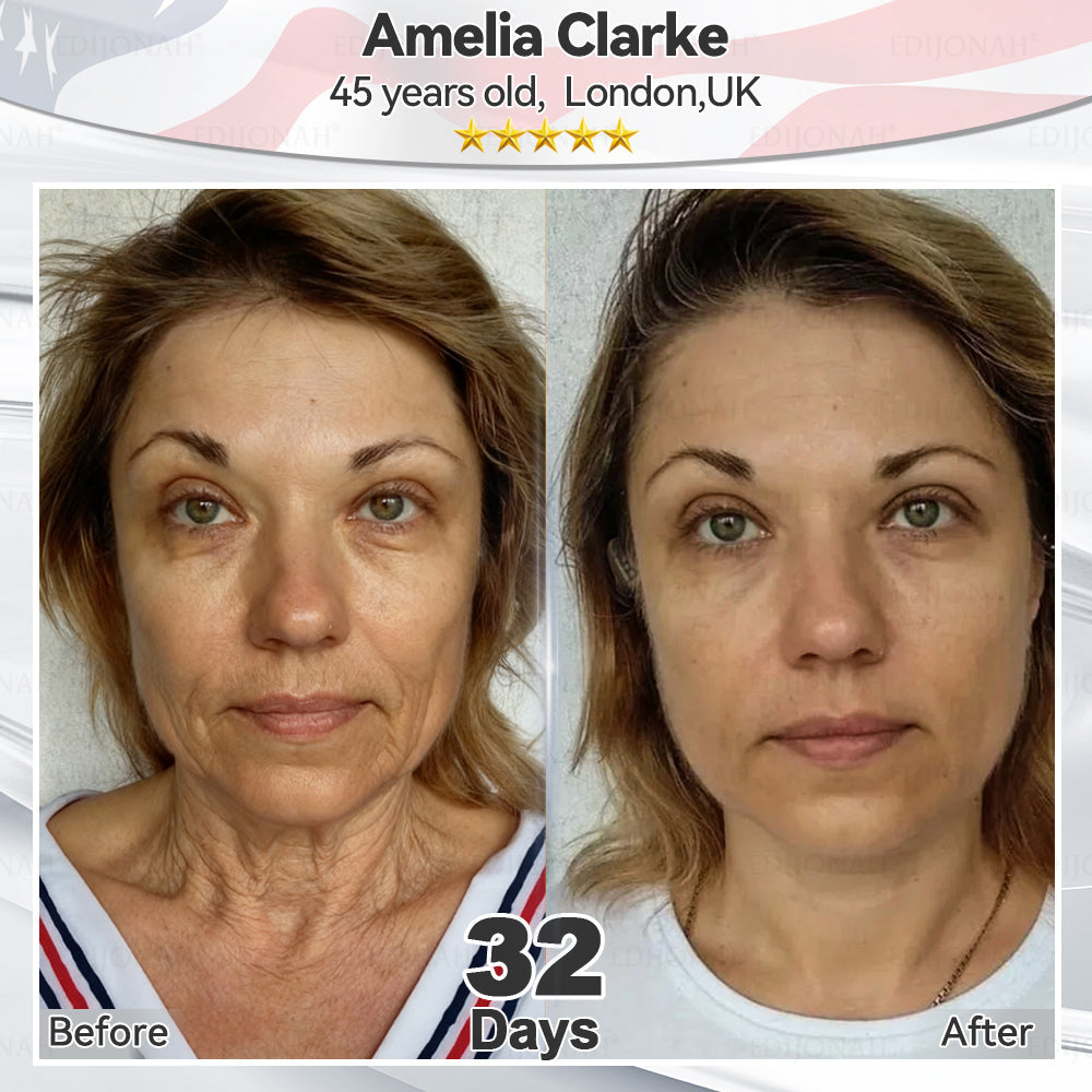 🎯🎯𝐸𝐷𝐼𝐽𝑂𝑁𝐴𝐻® 𝑆𝑡𝑒𝑚 𝐶𝑒𝑙𝑙 𝐸𝑥𝑜𝑠𝑜𝑚𝑒 𝑆𝑒𝑟𝑢𝑚  🐬🐬（ Anti-aging, reduces wrinkles, improves firmness, enhances radiance, provides deep hydration）