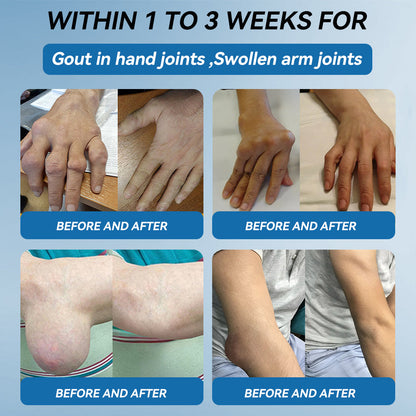 𝖯𝗂𝖼𝗱𝗼®🦞 B𝐏𝐂-𝟏𝟓7 Jo𝐢𝐧𝐭 𝐇𝐞𝐚ling Cr𝐞𝐚𝐦🦴Tre𝐚𝐭𝐬 𝐀𝐫𝐭𝐡𝐫itis, Neuro𝐩𝐚𝐭𝐡𝐲, 𝐑𝐡𝐞𝐮matism, Sp𝐨𝐫𝐭𝐬 𝐈𝐧𝐣𝐮ries & M𝐨𝐫𝐞👍