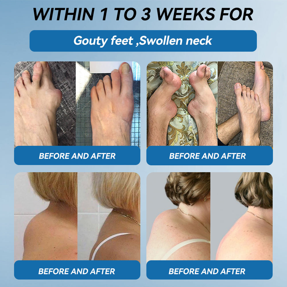 𝖯𝗂𝖼𝗱𝗼®🦞 B𝐏𝐂-𝟏𝟓7 Jo𝐢𝐧𝐭 𝐇𝐞𝐚ling Cr𝐞𝐚𝐦🦴Tre𝐚𝐭𝐬 𝐀𝐫𝐭𝐡𝐫itis, Neuro𝐩𝐚𝐭𝐡𝐲, 𝐑𝐡𝐞𝐮matism, Sp𝐨𝐫𝐭𝐬 𝐈𝐧𝐣𝐮ries & M𝐨𝐫𝐞👍