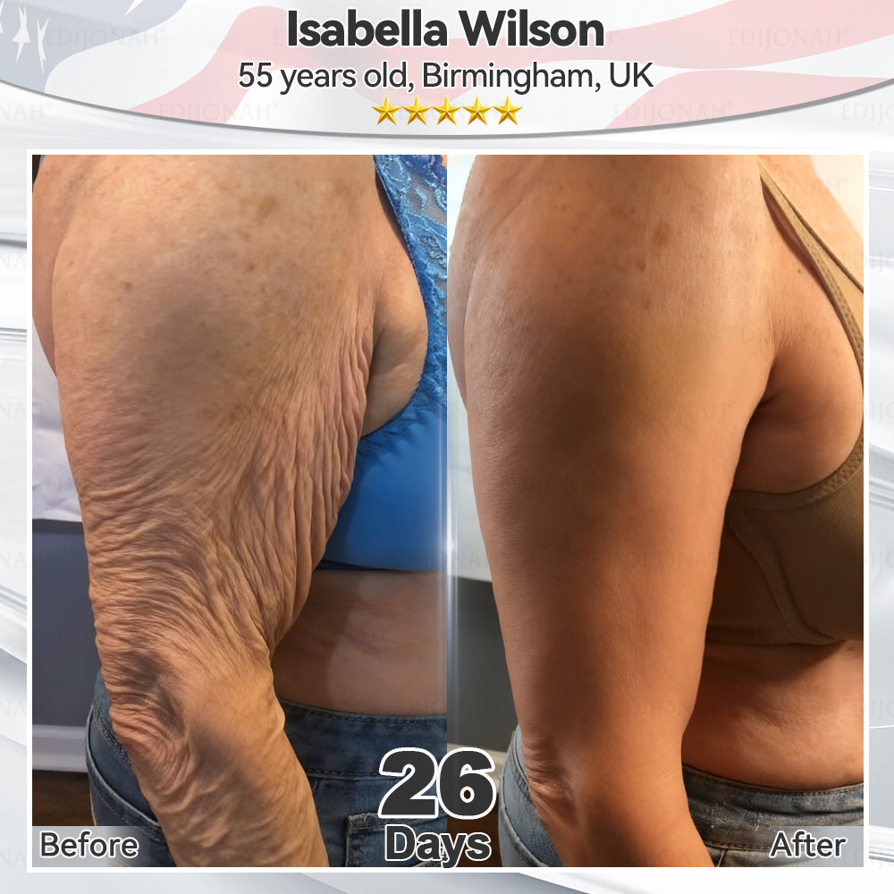 🎯🎯𝐸𝐷𝐼𝐽𝑂𝑁𝐴𝐻® 𝑆𝑡𝑒𝑚 𝐶𝑒𝑙𝑙 𝐸𝑥𝑜𝑠𝑜𝑚𝑒 𝑆𝑒𝑟𝑢𝑚  🐬🐬（ Anti-aging, reduces wrinkles, improves firmness, enhances radiance, provides deep hydration）
