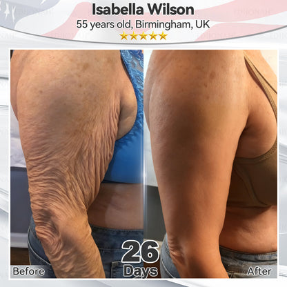 🎯🎯𝐸𝐷𝐼𝐽𝑂𝑁𝐴𝐻® 𝑆𝑡𝑒𝑚 𝐶𝑒𝑙𝑙 𝐸𝑥𝑜𝑠𝑜𝑚𝑒 𝑆𝑒𝑟𝑢𝑚  🐬🐬（ Anti-aging, reduces wrinkles, improves firmness, enhances radiance, provides deep hydration）