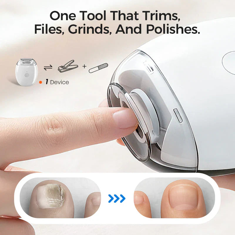 🎈🤴GLIMMERLY® Universal Automatic Fingernail Grinder for Adults and Children ✨🚩