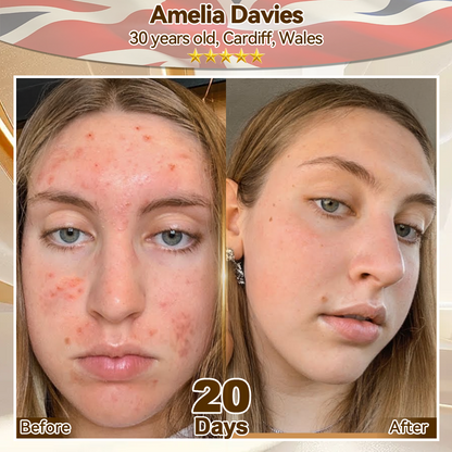 🌿𝐸𝐷𝐼𝐽𝑂𝑁𝐴𝐻® 𝑆𝑡𝑒𝑚 𝐶𝑒𝑙𝑙 𝐸𝑥𝑜𝑠𝑜𝑚𝑒 𝑆𝑒𝑟𝑢𝑚 -（ Anti-aging, reduces wrinkles, improves firmness, enhances radiance, provides deep hydration）英国  外泌体抗皱 定稿（副本）