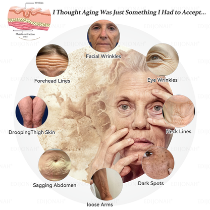 🎯🎯𝐸𝐷𝐼𝐽𝑂𝑁𝐴𝐻® 𝑆𝑡𝑒𝑚 𝐶𝑒𝑙𝑙 𝐸𝑥𝑜𝑠𝑜𝑚𝑒 𝑆𝑒𝑟𝑢𝑚  🐬🐬（ Anti-aging, reduces wrinkles, improves firmness, enhances radiance, provides deep hydration）