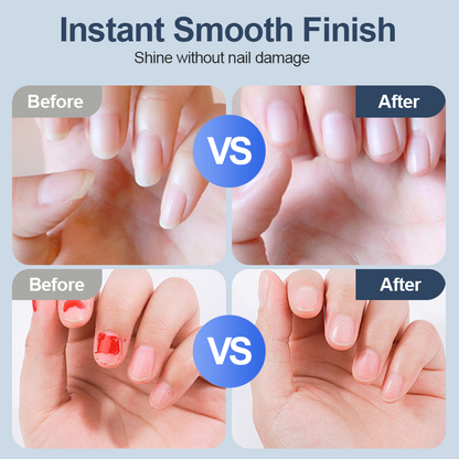 🎈🤴GLIMMERLY® Universal Automatic Fingernail Grinder for Adults and Children ✨🚩